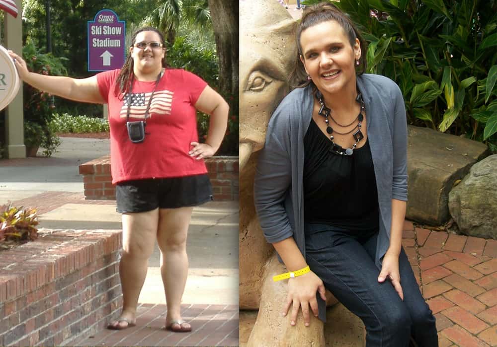 Bariatric Weightloss Surgery Testimonial