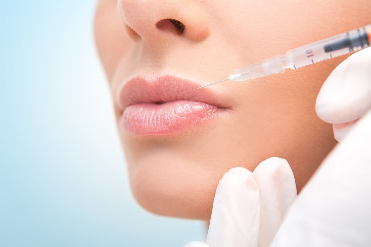 Dermal fillers Recovery: What to expect, Miami