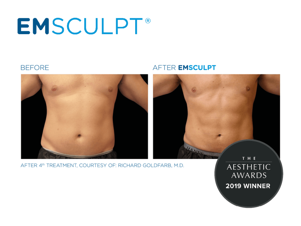 Emsculpt_Before & After Male