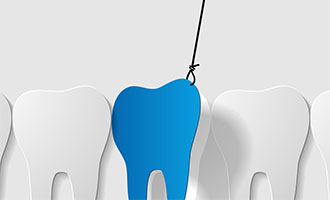 Tooth Extraction in San Jose