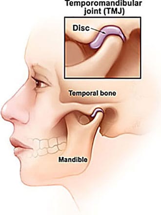 Diagram of TMJ facial parts