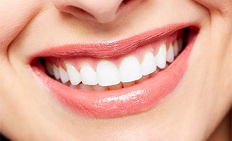 Full Smile Restoration in San Jose