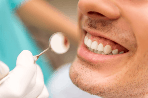 Dental inlays San Jose