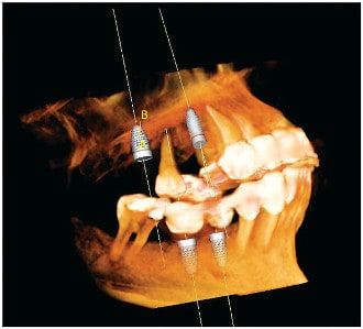 Advanced Dental Technology