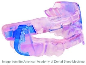 Oral appliance therapy in San Jose