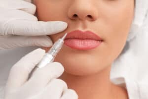 lip injections Virginia Beach