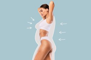 Body contouring after weight loss