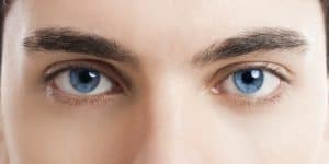 Woman's fresh eyes after Eyelid Surgery in Miami, FL