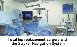 Total hip replacement surgery with the Stryker Navigation System 