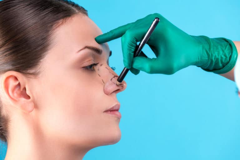 Rhinoplasty Candidacy
