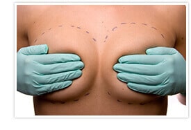 Breast implants in New York City
