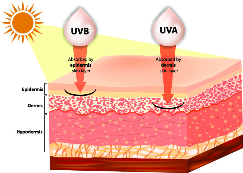 Skin care treatment for sun damage Carmel