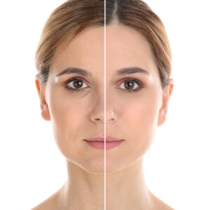 Plastic surgery trends vs timeless changes in NYC