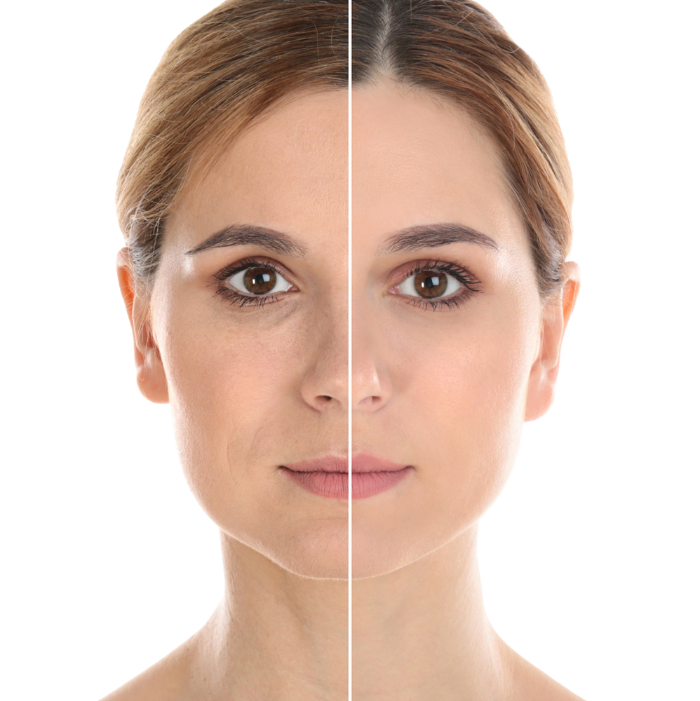 Plastic surgery trends vs timeless changes in NYC