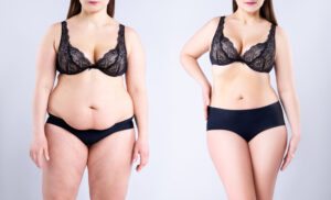 Transform with a tummy tuck 360