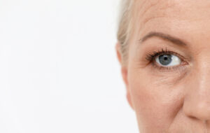 Brow lift to replace Botox in NYC