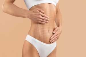 Woman touching her toned, slim belly after a SmartLipo procedure