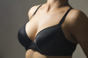 Woman wearing black bra considers nipple areola correction in Westchester county