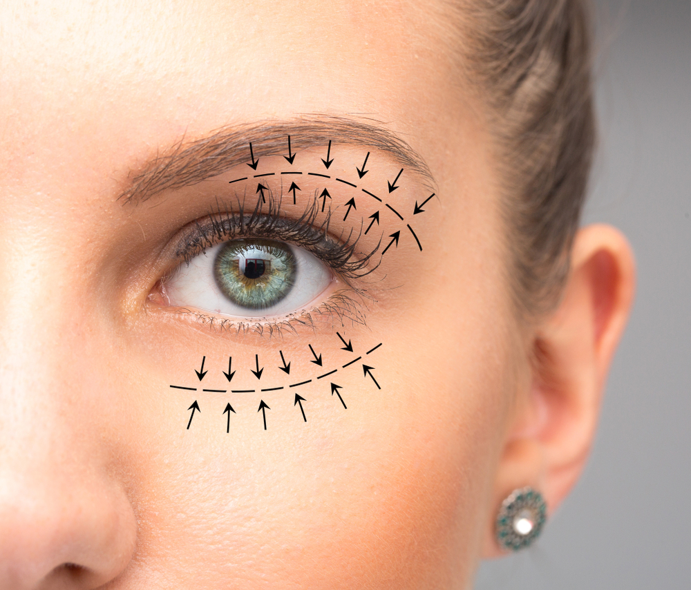 Close-up shot of a woman's eyes after blepharoplasty in New York City