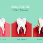 Health problems linked to gum disease