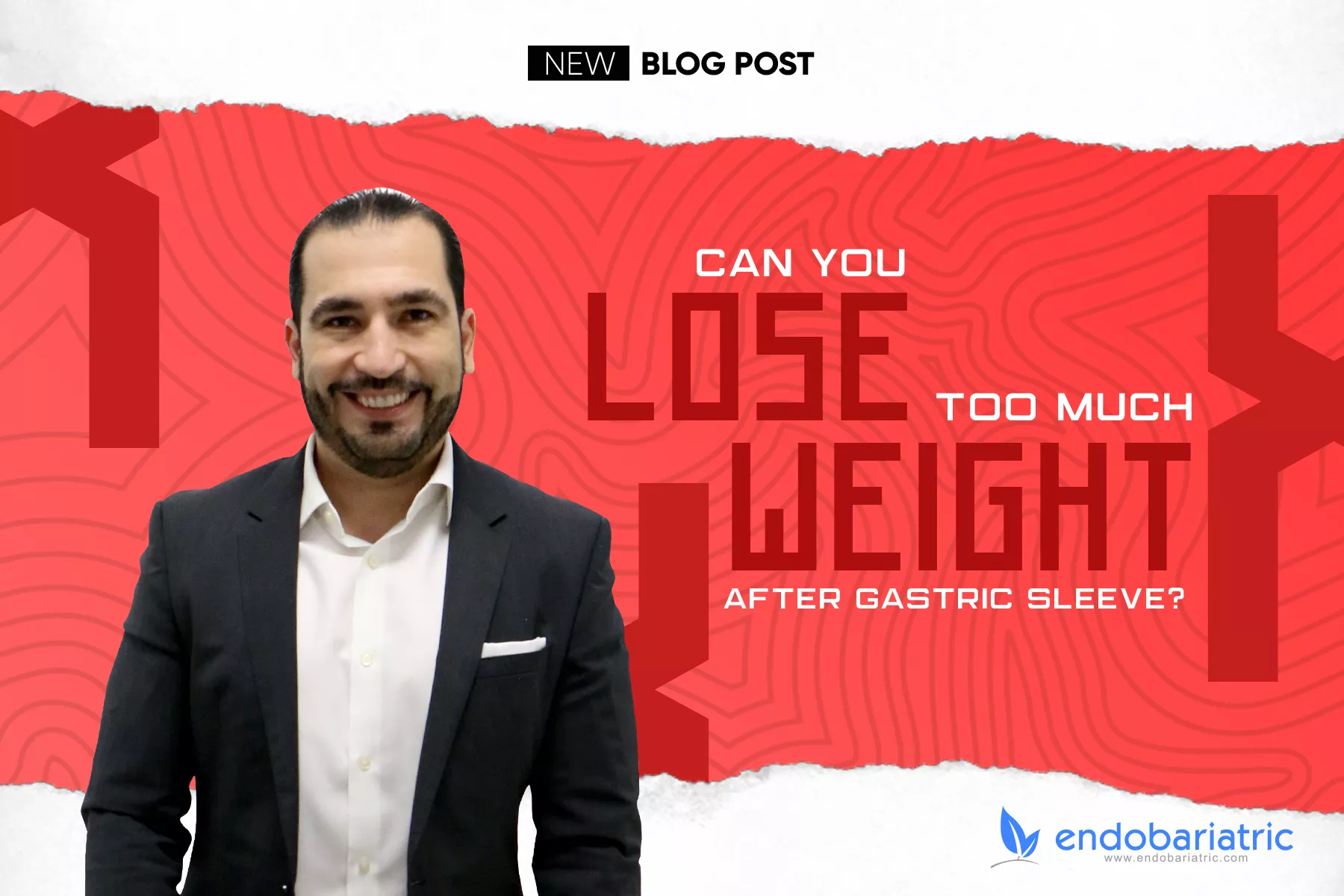 Can You Lose Too Much Weight After Gastric Sleeve? Gastric Sleeve Mexico