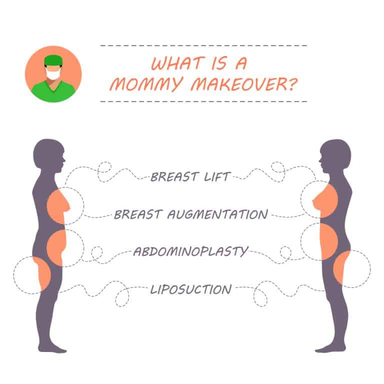 Mommy Makeover Detroit, Michigan