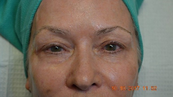 microblading charlotte NC