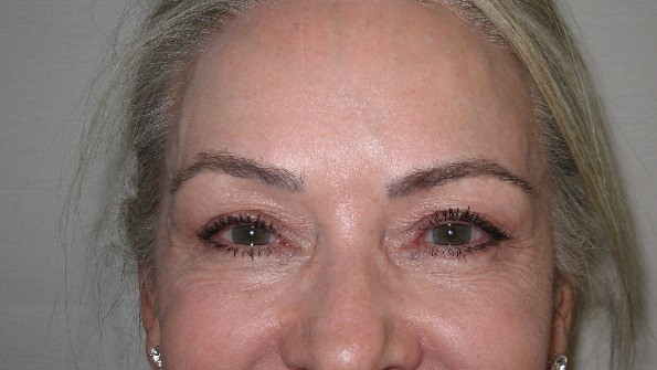 microblading Patient charlotte NC