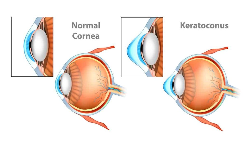 Introduction To The Eye