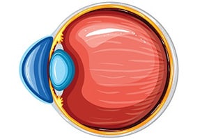 Keratoconus Treatment in Downtown Los Angeles