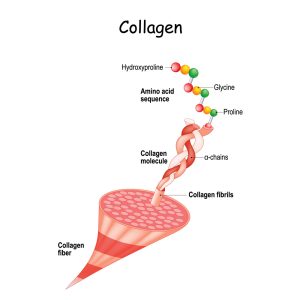 corneal cross-linking Los Angeles