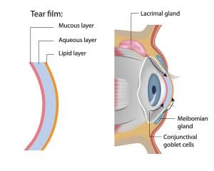 Environmental causes of dry eyes Los Angeles