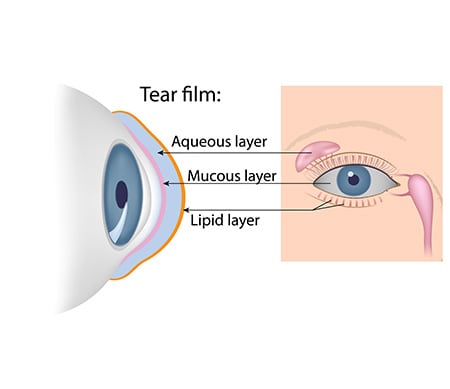 Tratamiento para el ojo seco Los Ángeles