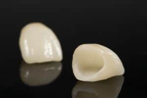 Porcelain & Ceramic Crowns in Urbandale, IA