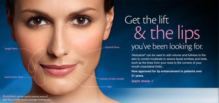 Restylane Dermal Filler Portland