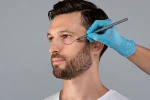 Lower Eyelid Surgery for Men in Portland