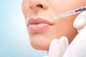 Dissolving Dermal Fillers