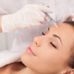 Botox injections reducing wrinkles and fine lines