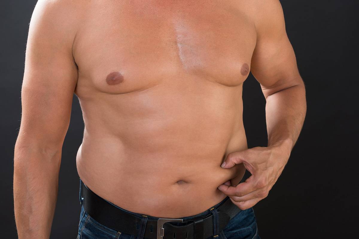 Can an Overweight Person Get a Tummy Tuck?