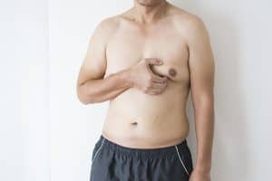 Gynecomastia treatment, Westlake, OH