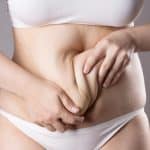 Woman twists her loose belly skin following major weight loss as she prepares for a tummy tuck