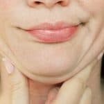 Woman grimaces as she squeezes loose fat and skin under her chin and considers neck lipo