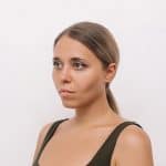 Young woman looks sad after weight loss caused facial hollowing