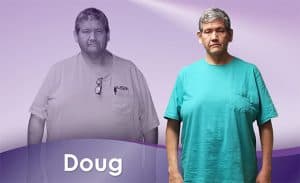 Before and After Weight Loss Doug