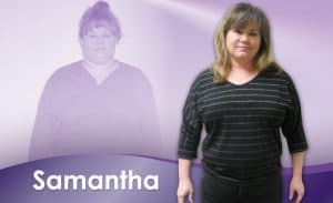Before and After Weight Loss Samantha