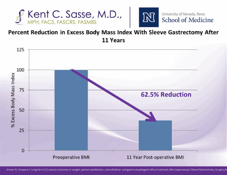 sasse-surgical-reno-sleeve-gastrectomy-11-years-later