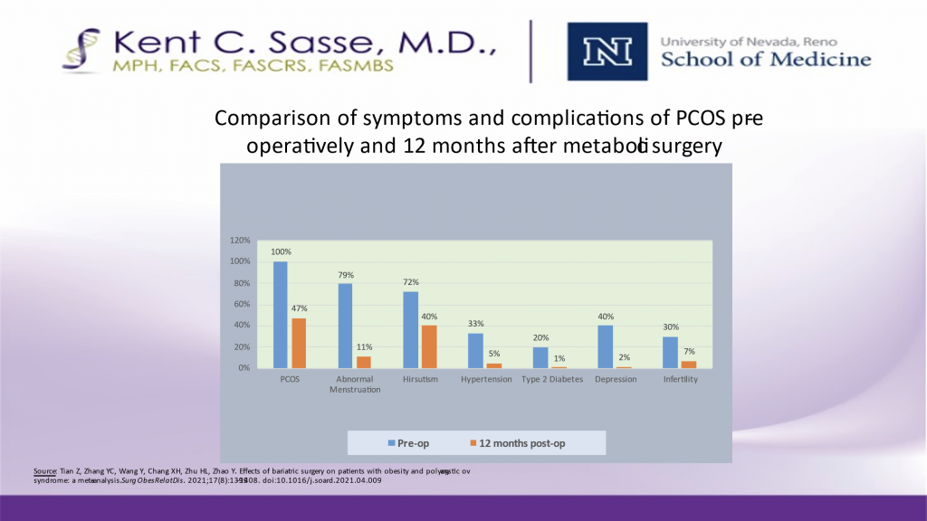 sasse-surgical-PCOS-bariatric-surgery