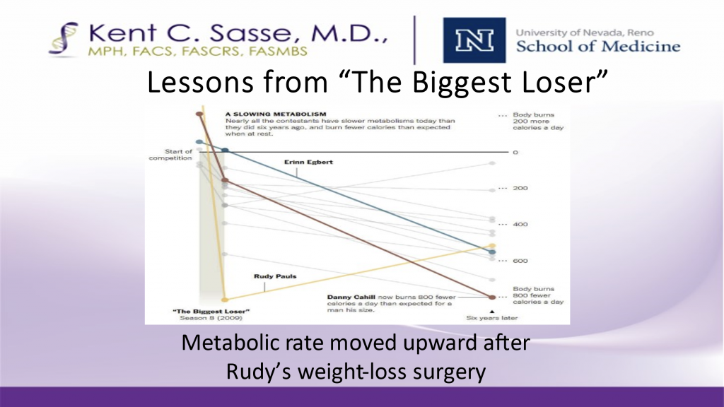 lessons-from-the-biggest-loser-sasse-surgical