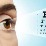 LASIK for astigmatism