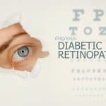 Woman's eye accompanied by text that reads Diagnosis: Diabetic Retinopathy